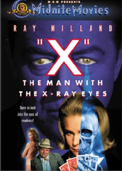 X