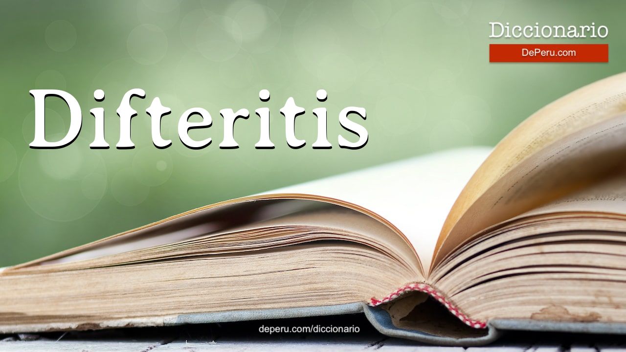 Difteritis