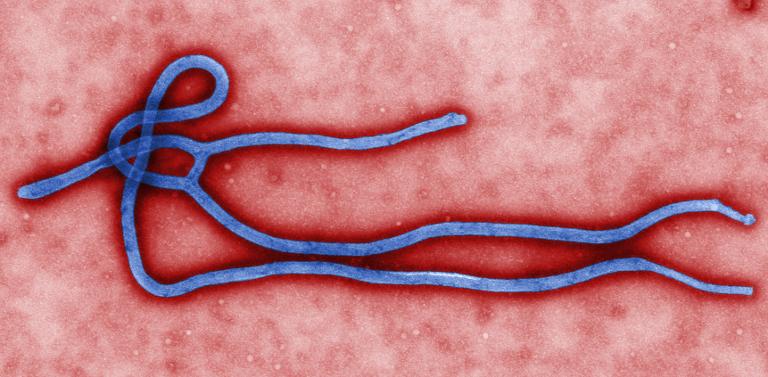 salud - ébola - EEUU - juguetes - insólito