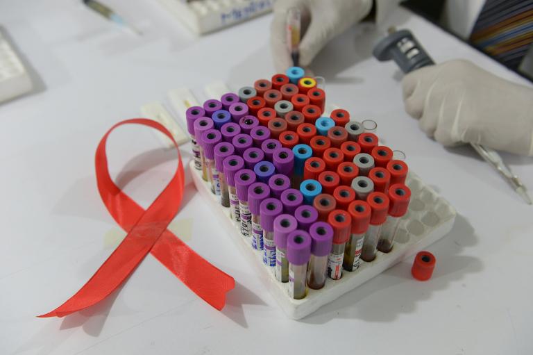 EEUU - epidemia - ciencias - sida - virus - salud