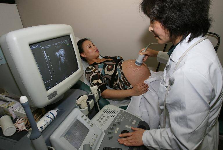 OMS - partos - cesárea - mujeres - salud - sociedad