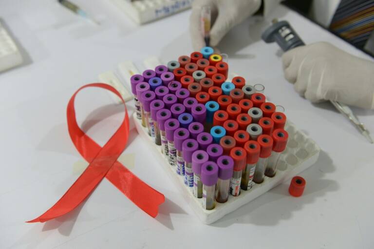 EEUU - gobierno - sida - virus - salud