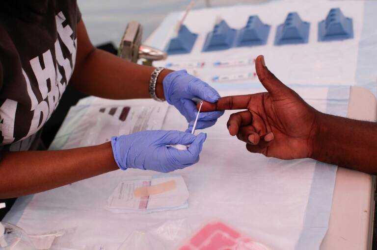 USA - épidémie - virus - santé - pandémie - recherche - sida