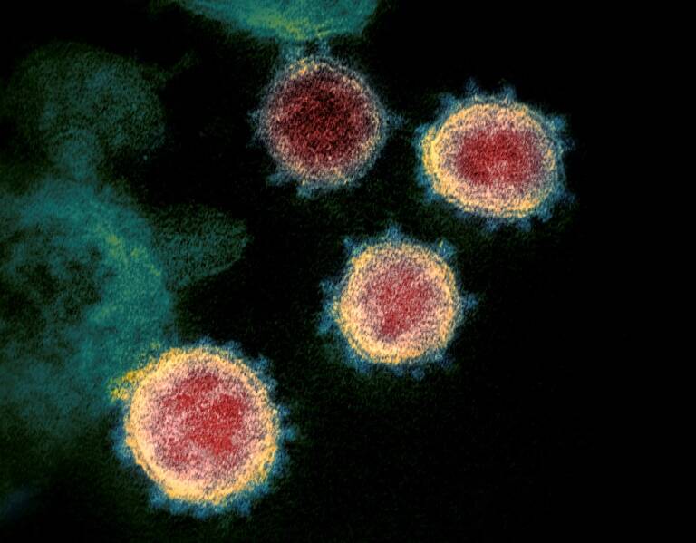 santé - virus - pandémie - épidémie - maladies - étude