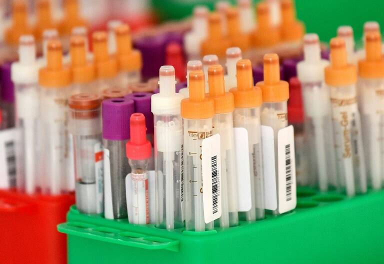 Alemania - UE - pandemia - salud - virus - empresas - inversión