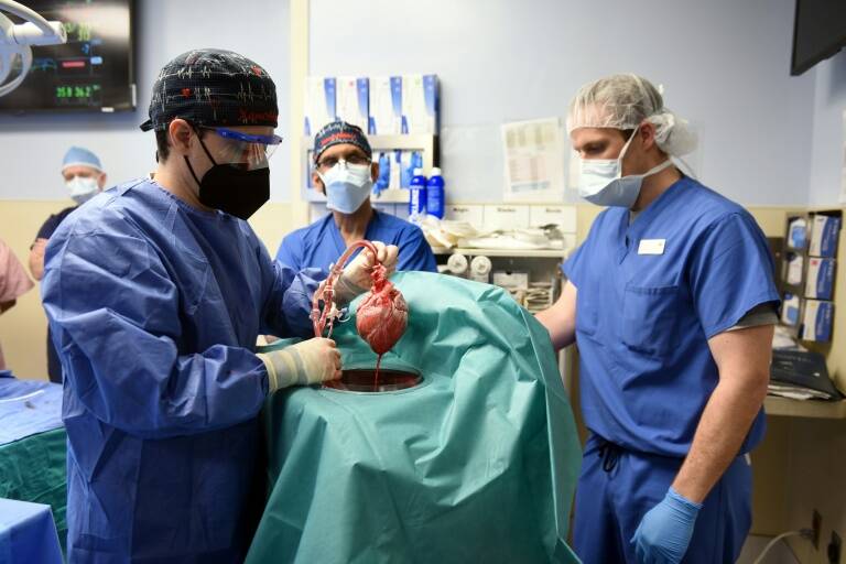 EEUU - salud - trasplante - cerdo - corazón