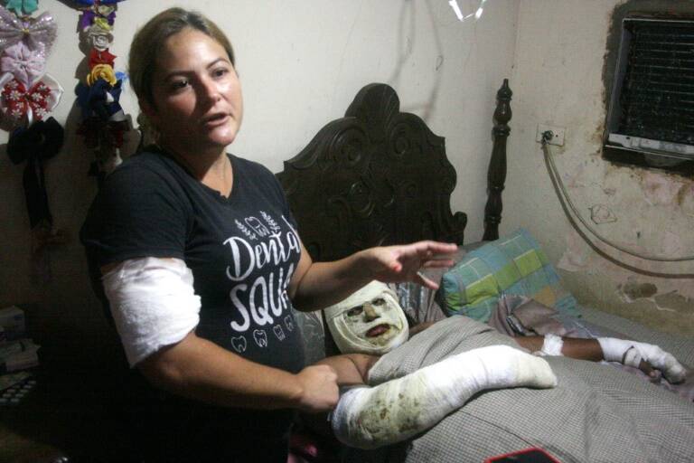 Venezuela,gasolina,sociedad,economía,accidente,petróleo