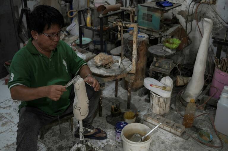 Indonesia - salud - enfermedad - lepra